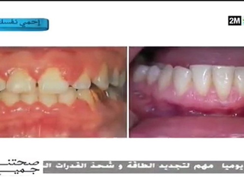 صحتنا جميع: الأحد 15 ماي