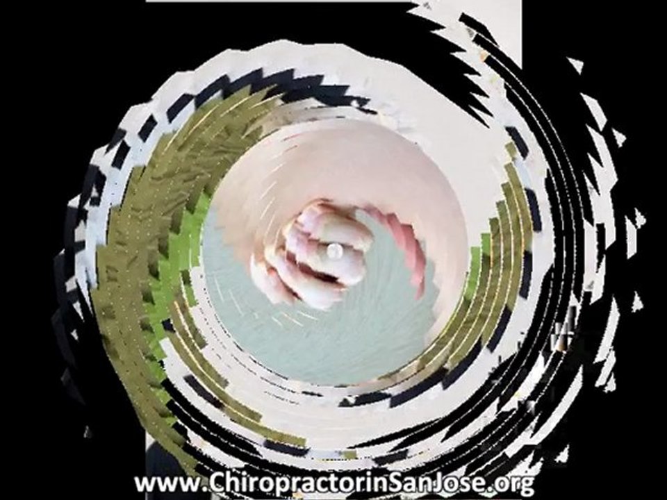Chiropractor in San Jose - Understanding Chiropractic Techniques