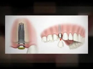 Guelph Cosmetic Dentist