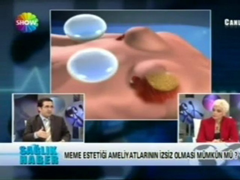 İzsiz meme Büyütme Ameliyatı & Op Dr Ali mezdeği