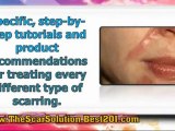 scar treatment reviews - best scar treatment - treatment for scars