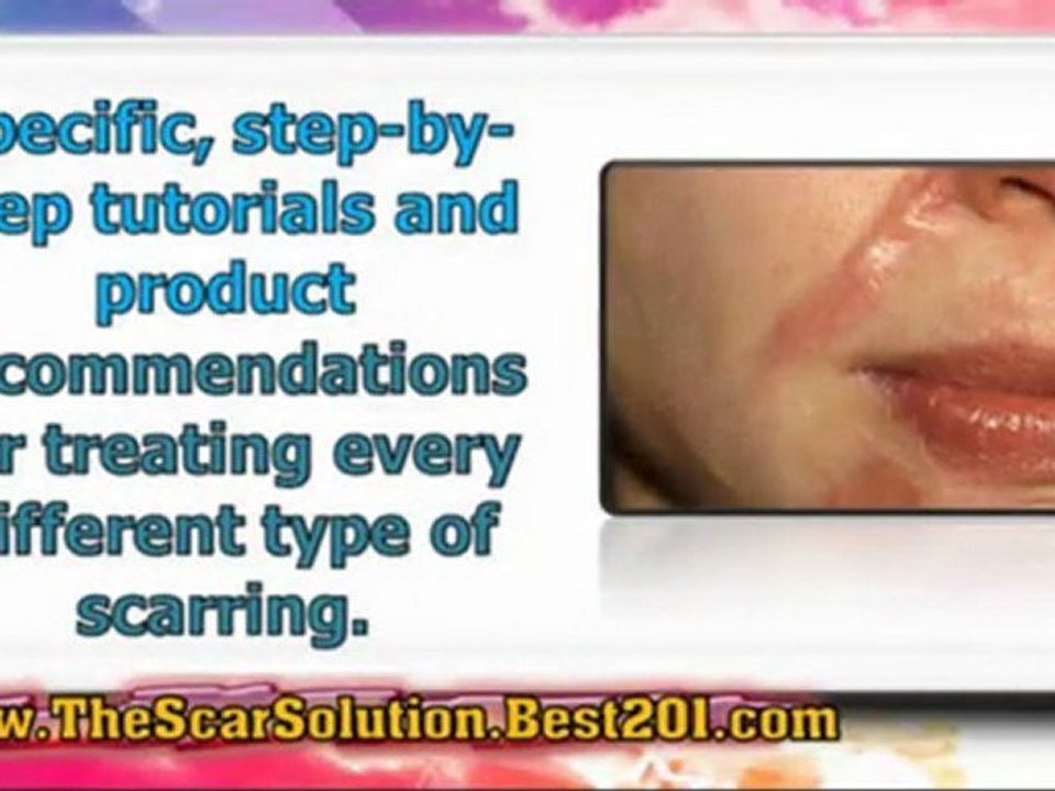 removing scars - facial scar removal - burn scar removal
