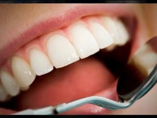 Lakewood Dentists *COUPON* Call Today! (303) 237-4831