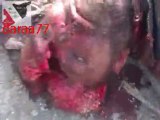 مجزرة بحق المدنيين في درعا المحاصرة3