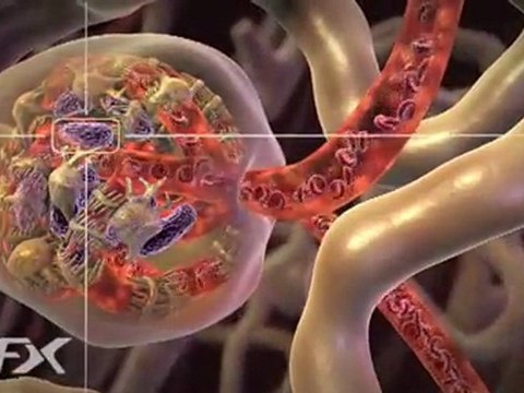 How diabetic nephropathy works