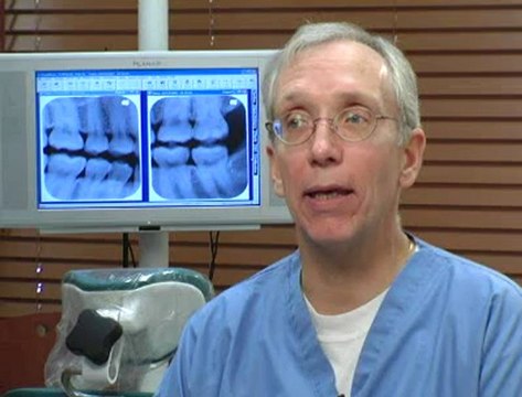 Best Dental Fillings SmilesofSkokie.com