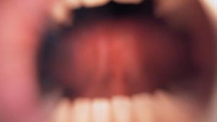 How To Stop Hiccuping
