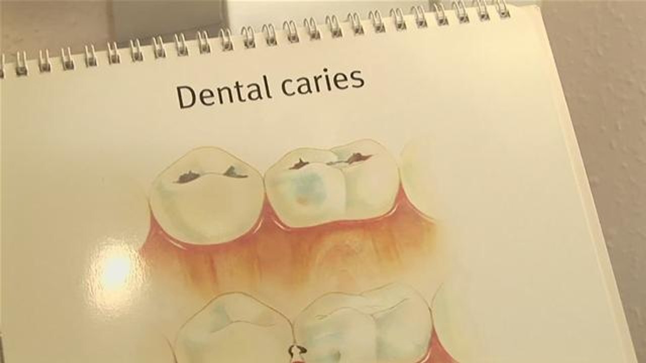 Ways Of Avoiding Tooth Decay