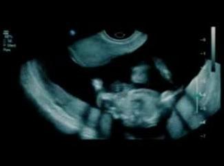 Gad Elbaz & Alon De Loco - Or