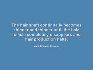 Hair Care Generic Drugs // Propecia