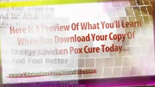 chicken pox treatment - chicken pox in babies - adult chicken pox