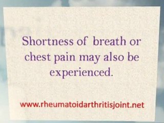 Rheumatoid Arthritis Treatment