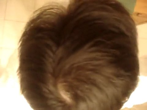 Order Generic Finasteride (buy Finpecia) 1mg