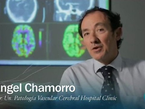 Sintomas del ictus: Angel Chamorro
