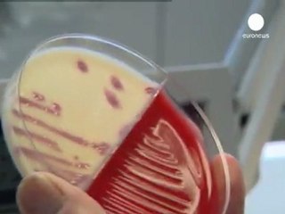 Epidemia E.coli: la Commissione Ue lancia l'allarme