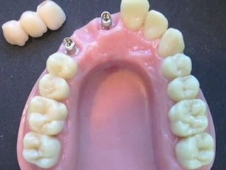 Dental Design Gerven Dental-Design Jörg Seidel