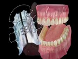 Diş Sağlığı BulSep