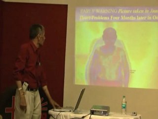Natural Bypass -- Psychic Surgery, Spiritual Healing Part 3.wmv