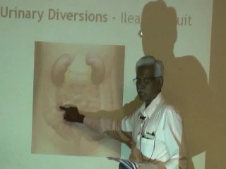 Life as an Ostomate - Learn about their Association Part 1.wmv