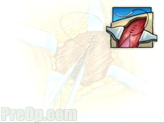 General Laparoscopy Diagnostic  - Alternatives