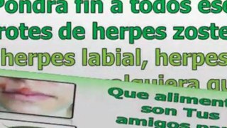 herpes zoster tratamiento natural - cura para el herpes