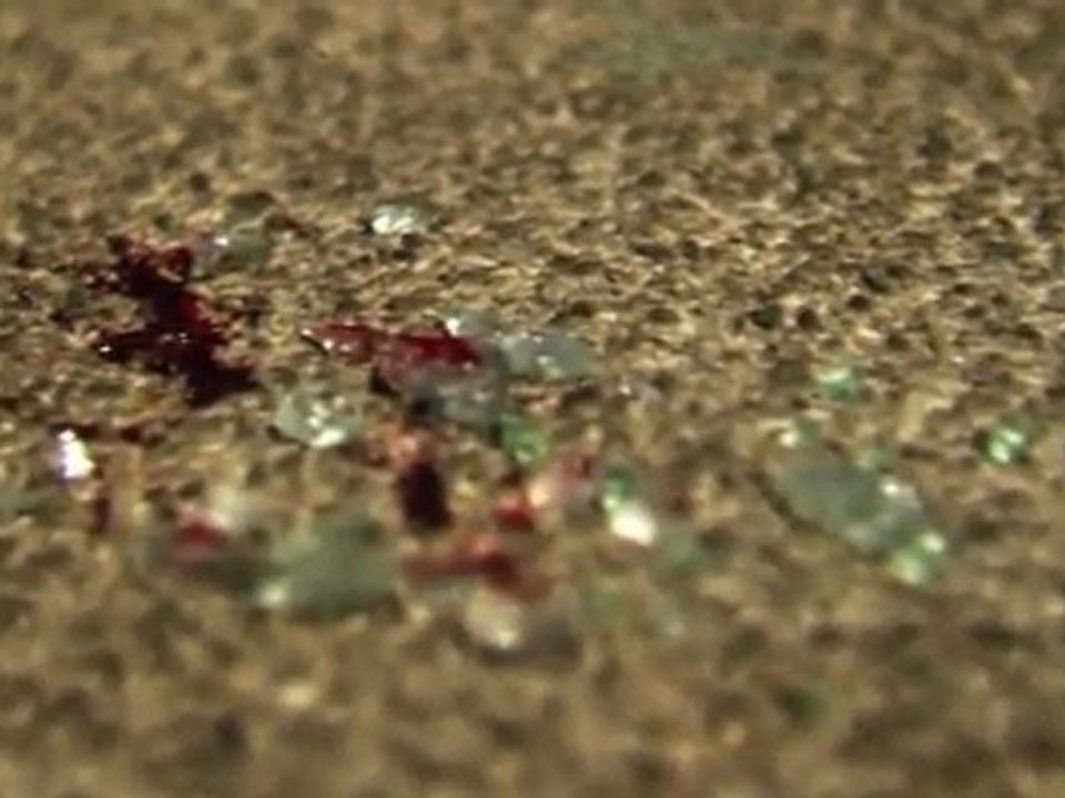 TEASER TRAUMA