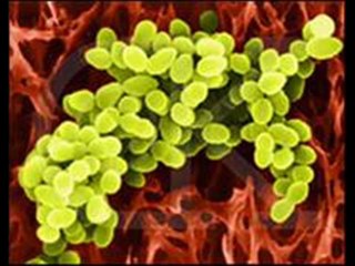 TVG-9 BARTEK KALINOWSKI - CHEMICZNY DONEK (Chemiczny Ali w Wersji Soft)