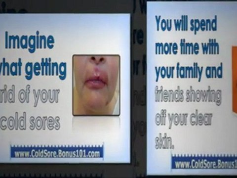 best treatment for cold sores - how do you get rid of cold sores - how do you get rid of a cold sore