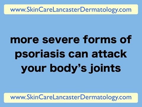 Dermatologist Lancaster PA - Dermatology Lancaster PA