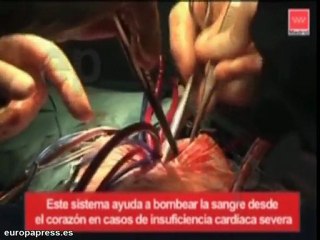 Download Video: Implantan un corazón artificial a un bebé