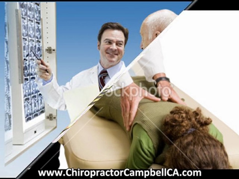 Chiropractor Campbell CA