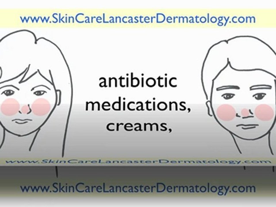 Dermatologist Lancaster PA - Dermatologist in Lancaster PA