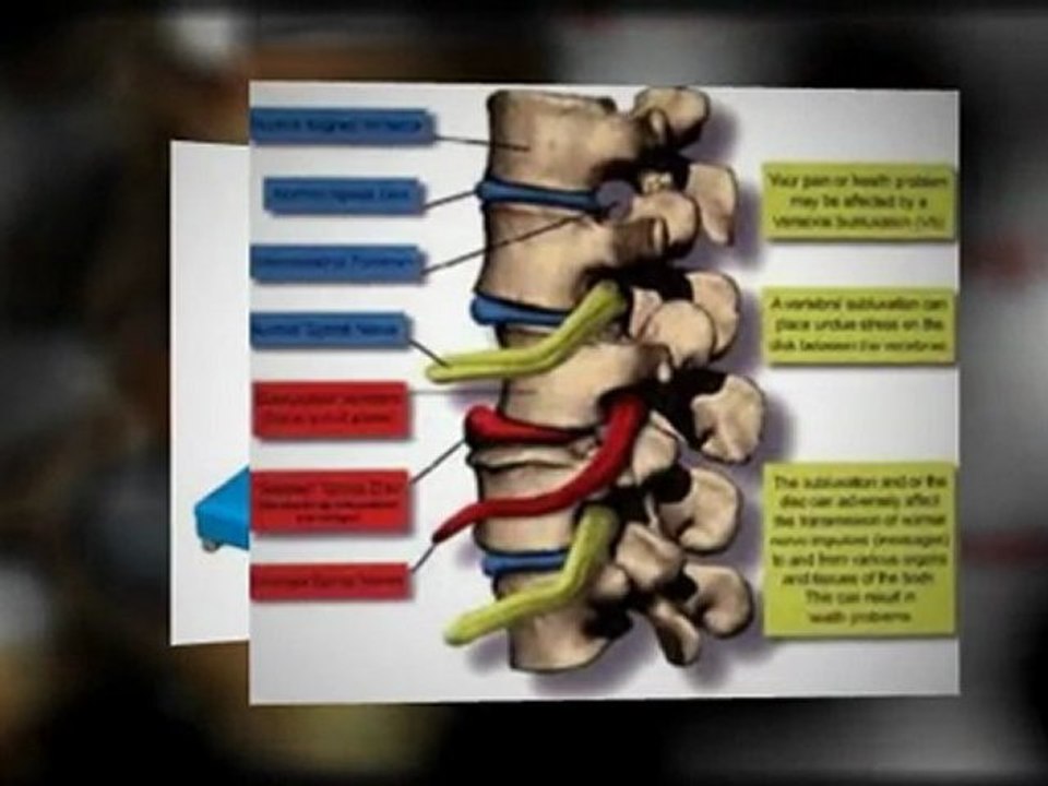 Chiropractic Clinic Oceanside CA