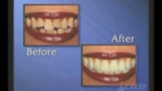 Cosmetic Dentistry by Kamran Sahabi Dentist Glendale, CA
