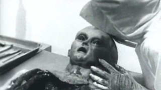 Alien de Roswell : Autopsie