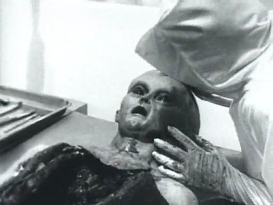 Alien de Roswell : Autopsie