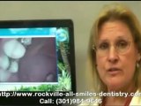 Rockville Cosmetic Dentistry - Intra-Oral Camera