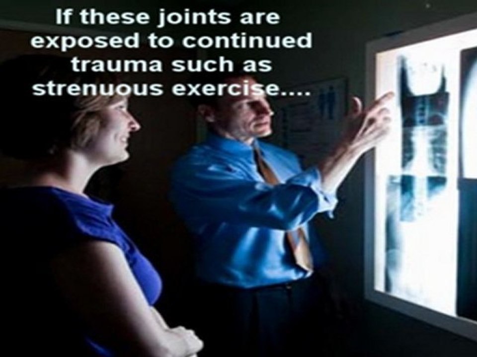 Help Your Osteoarthritis Westchester County Chiropractor