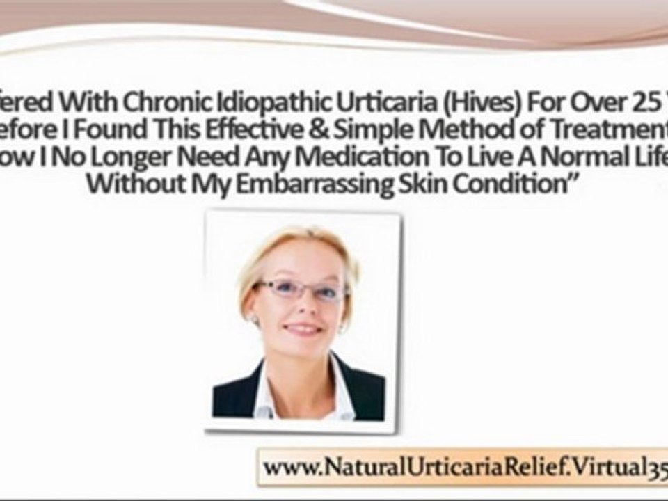 papular urticaria - solar urticaria - idiopathic urticaria