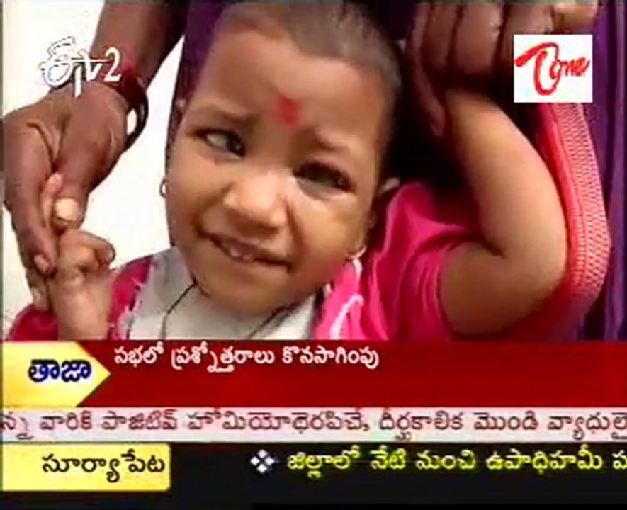 ETV2 Sukhibhava -  Glaucoma   - Doctor Suggestions -  03