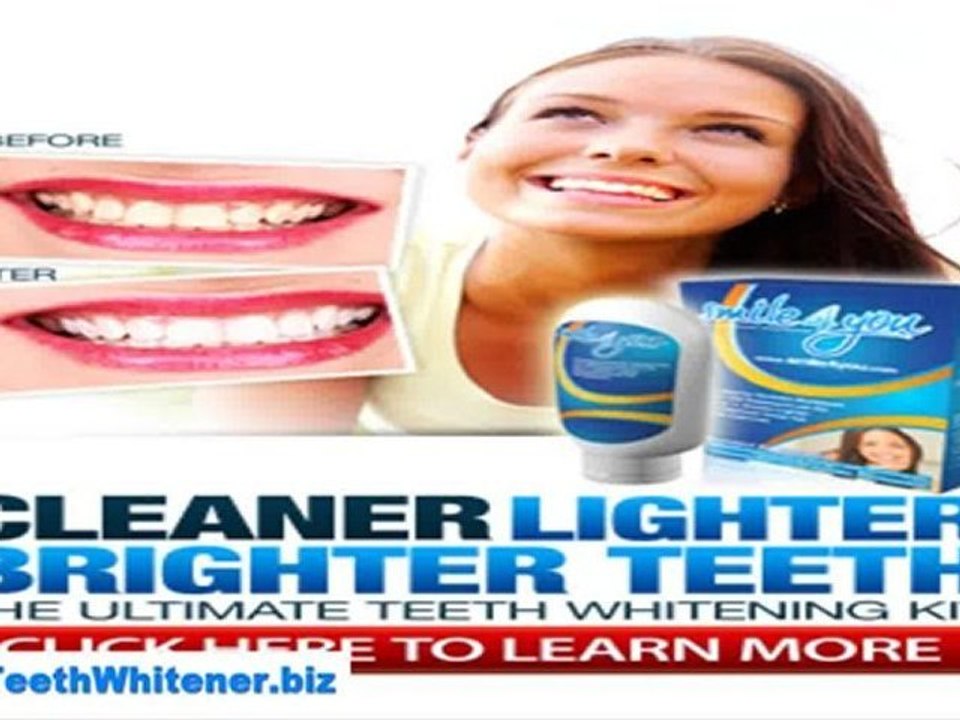 Fast and effective tooth whitener