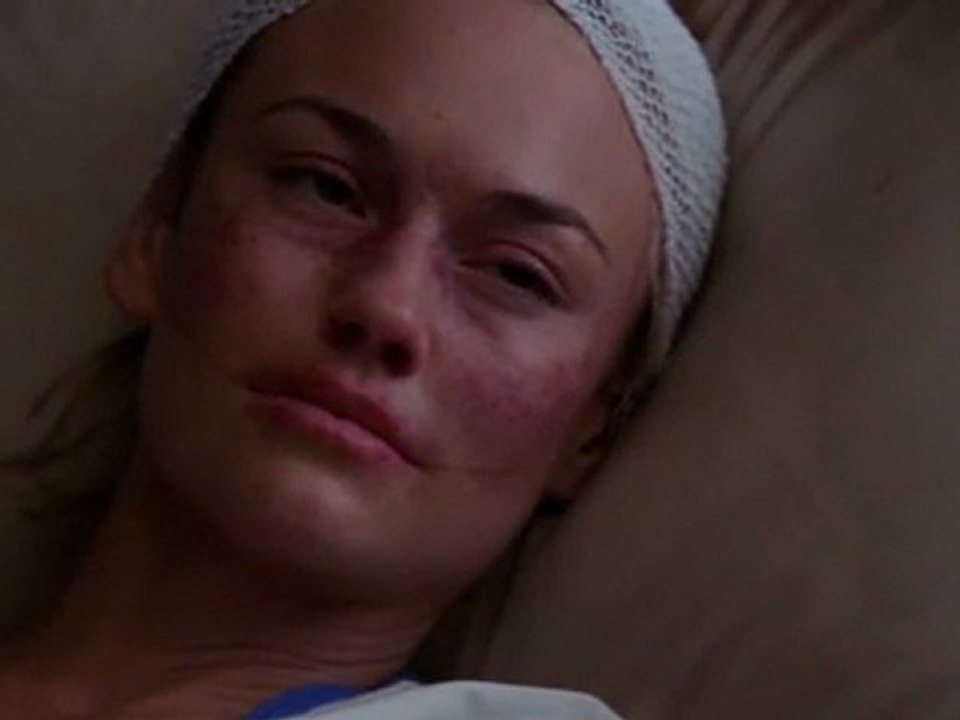 Christian and Kimber - Kimber breaks up with Christian post-surgery.
