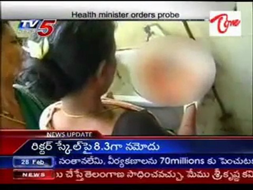 Dog kills infant at KGH in Vizag, Health Minist...