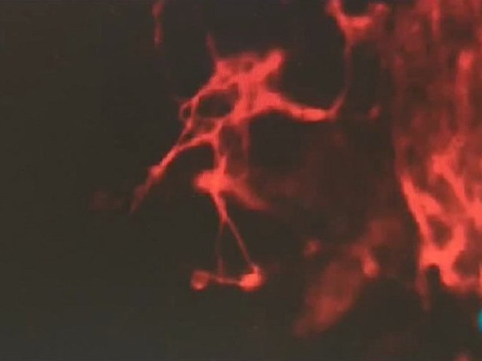 Celulas madre pluripotentes inducidas (IPS)