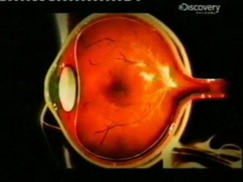 Toxoplasmosis: Parasitos en la retina (Toxoplasma gondii)