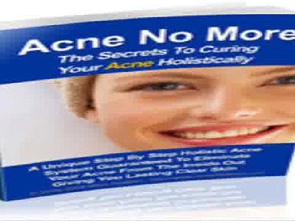 Hormones and Acne
