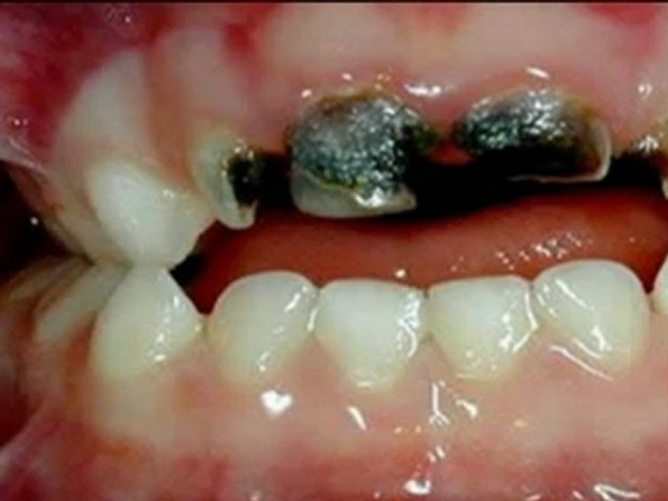 JOSHUA EST CHEZ LE DENTISTE EPISODE 7 PAR TIPOYOCK MALCOLM JACKSON WEBSERIE