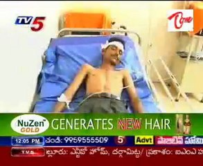 Physical attack with hammer on Pepsi Employees in Prakasam District