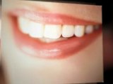 Beverly Hills Teeth Whitening