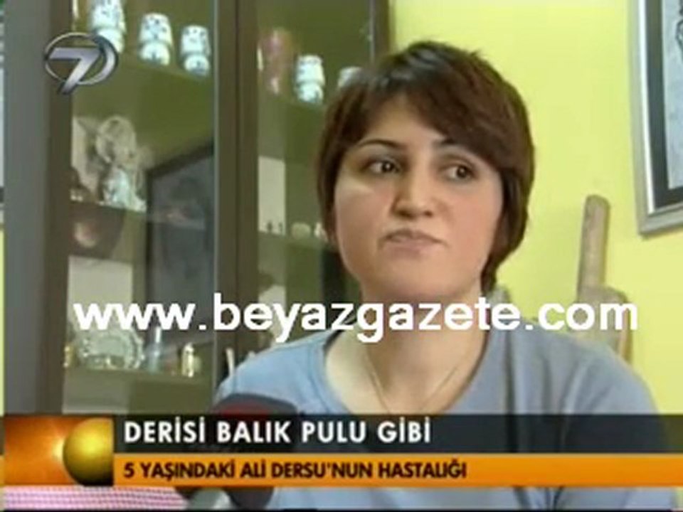Derisi Balık Pulu Gibi Kanal 7 Video - 16 Şubat 2010 Salı